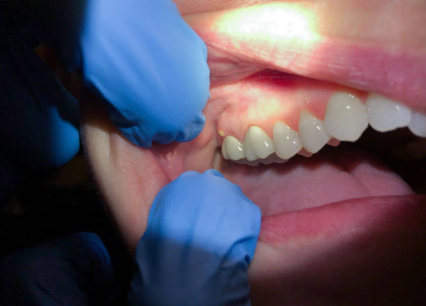 Best Emergency Treatment for Toothache in Hillsboro, OH
