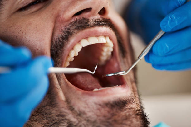 Best Walk-In Emergency Dentist in Hillsboro, OH